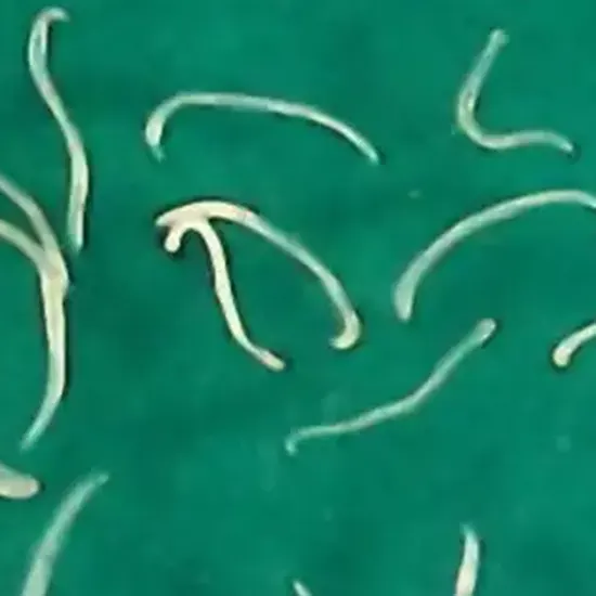 Hookworm : The Silent Bloodsucker Hooked On Your Intestines